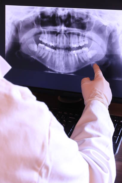Best Emergency Treatment for Dental Infections or Abscesses in Tunkhannock, PA
